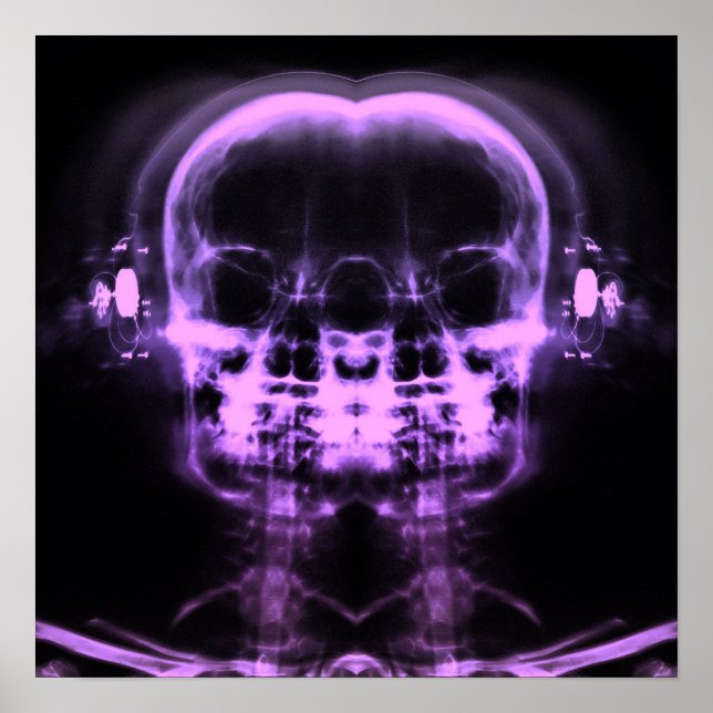 Póster Calaveras de doble rayos X con audífonos - Púrpura (Frente)