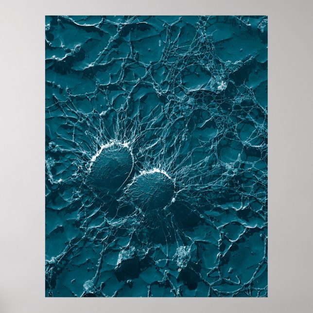 Póster Celdas bacterianas de Staphylococcus Aureus Se ace (Frente)