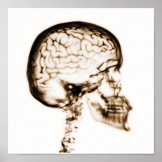 PÓSTER CEREBRO DE RAYOS X - NARANJA (Frente)
