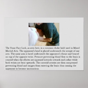 Póster Cerradura delantera de la cara u obstrucción