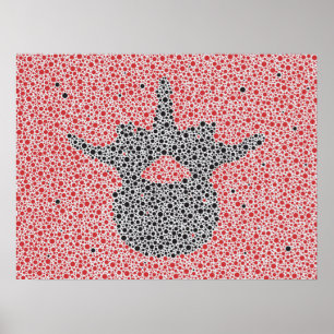 Póster Chiropractic Anatomy Artwork Lumbar Vertebrae