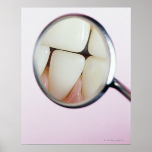 Póster Cierre de dientes reflejados en el espejo dental