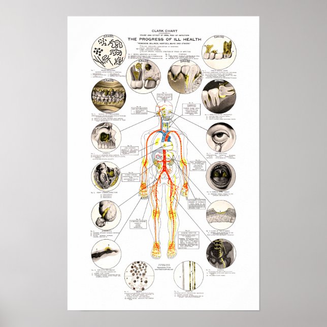 Póster Clark Dental Health Chart for Dentist (Frente)