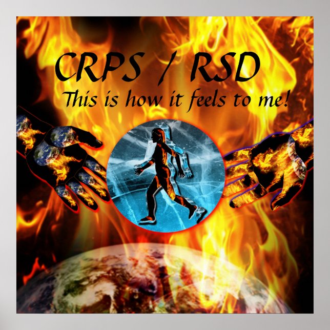 Póster CRPS/RSD ¡Así me siento! Blzn Poster (Frente)