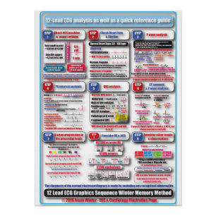 POSTER de formación de ECG