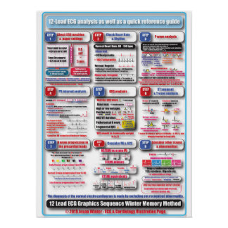POSTER de formación de ECG