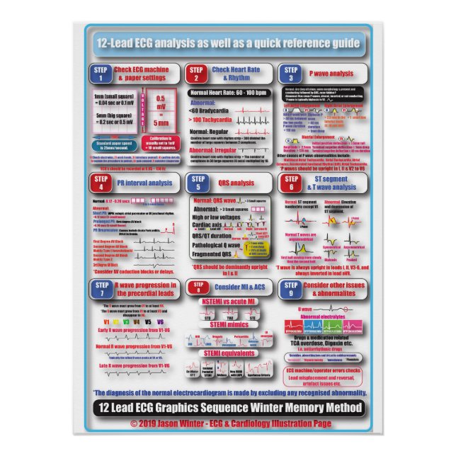 POSTER de formación de ECG (Anverso)