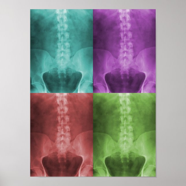 Poster de lienzo de arte de rayos X digital (Frente)