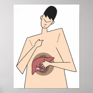 Póster Detección temprana de enfermedades hepáticas.