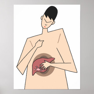 Póster Detección temprana de enfermedades hepáticas.
