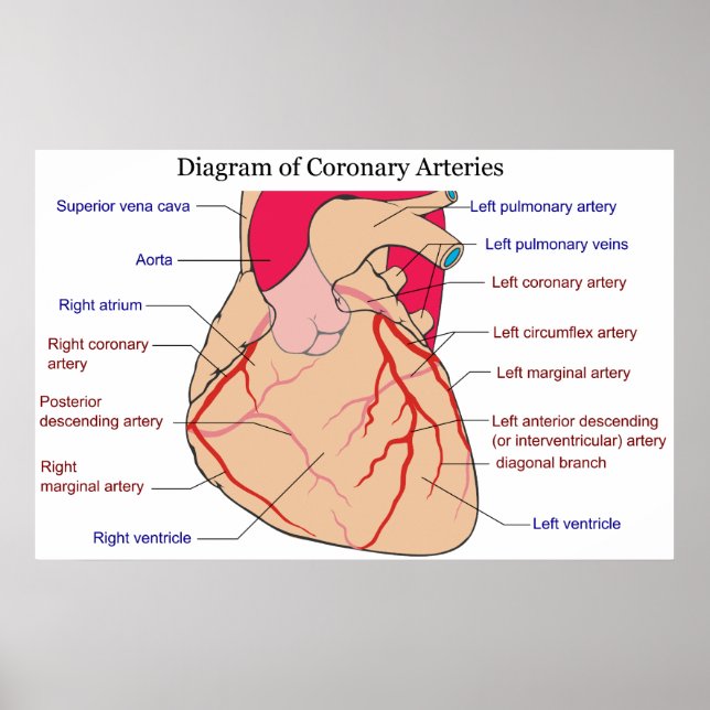 Póster Diagrama de las arterias coronarias de un corazón  (Frente)