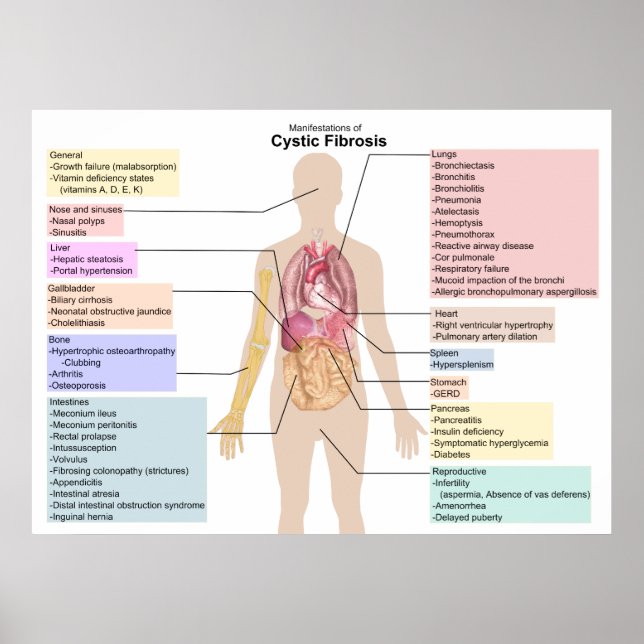 Póster Diagrama de las manifestaciones de la fibrosis quí (Frente)