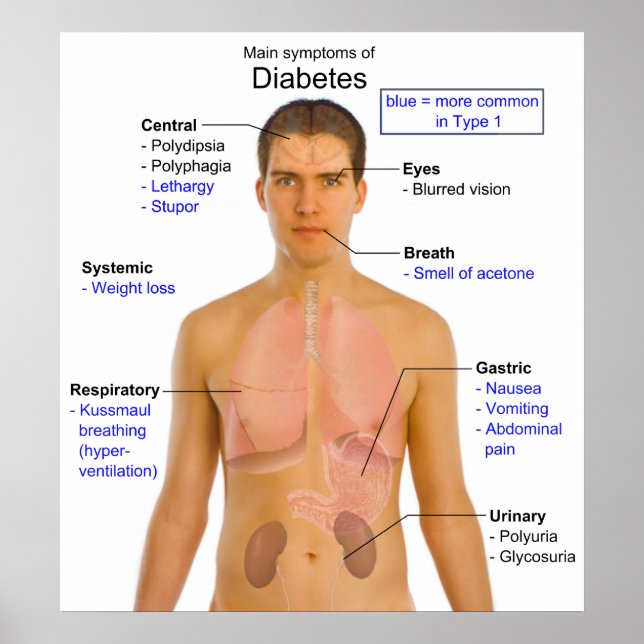 Póster Diagrama de los principales síntomas de la diabete (Frente)