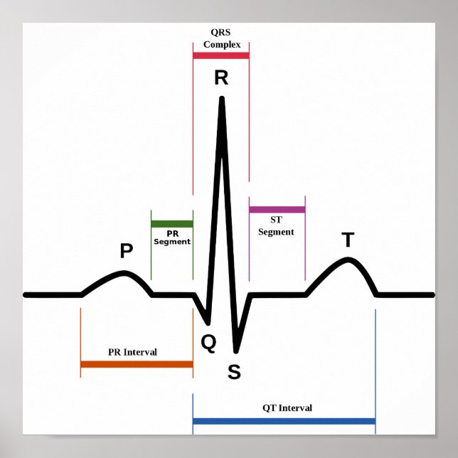Póster Diagrama del ECG del electrocardiograma del ritmo  (Frente)