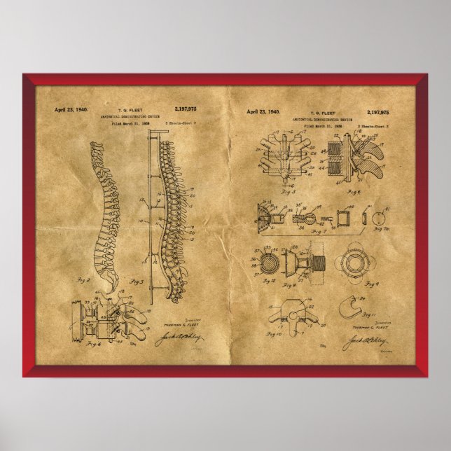 Póster Dibujo de columna vertebral antiguo (Frente)