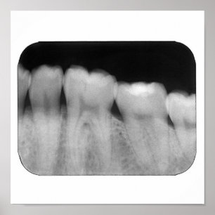 Póster Dientes con el relleno