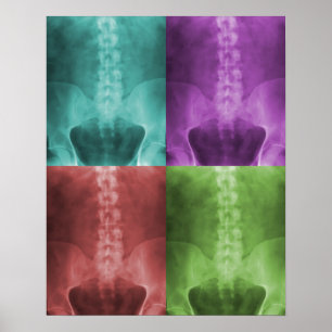 Póster Digital X-Ray Art Print
