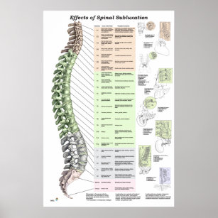 Póster Efectos de la subluxación espinal Poster Quiroprác