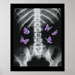 Póster Egirl Xray Skeleton Mariposa Rosa Harajuku Y2k Da