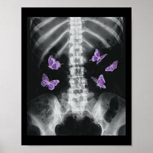 Póster Egirl Xray Skeleton Mariposa Rosa Harajuku Y2k Da