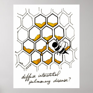 Póster Enfermedad pulmonar intersticial difusa