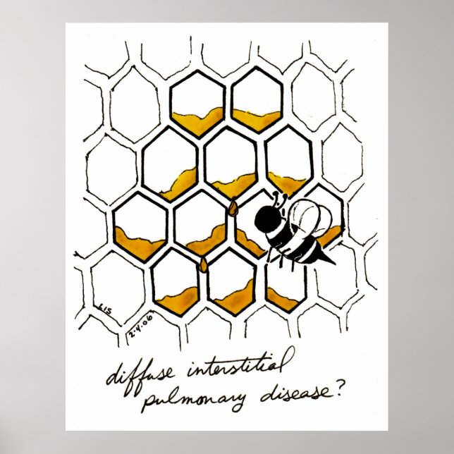 Póster Enfermedad pulmonar intersticial difusa (Frente)