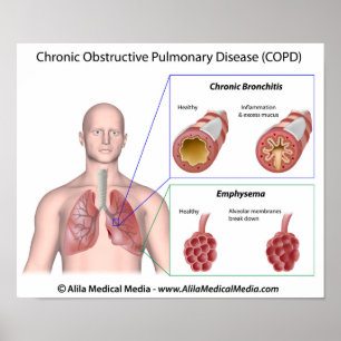 Póster Enfermedad pulmonar Poster etiquetado con EPOC