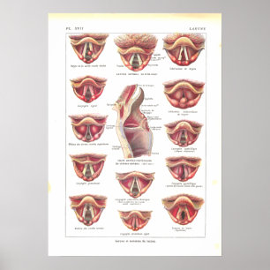 Póster Enfermedades del francés del poster de la anatomía