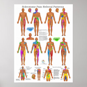 Póster Esclerotoma Dolor conjunto Poster de remisión Quir