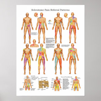 Póster Esclerotoma Poster de remisión del dolor visceral