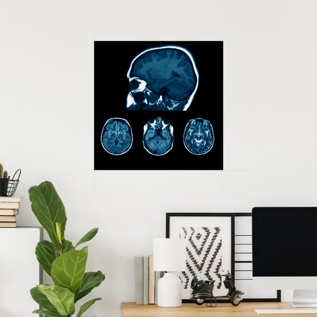 Póster Exploración de Mri en el cerebro (Oficina en casa)
