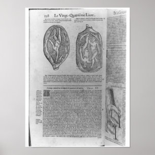 Póster Feto, ilustracion de las 'obras