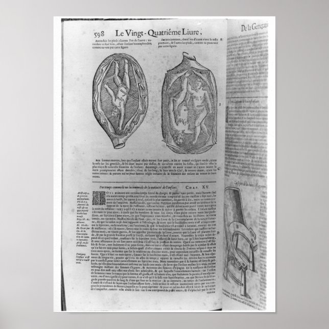 Póster Feto, ilustracion de 'Oeuvres' (Frente)