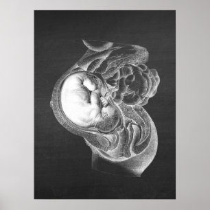 Póster Fetus Womb Anatomy Obstetrics Decor no. 2