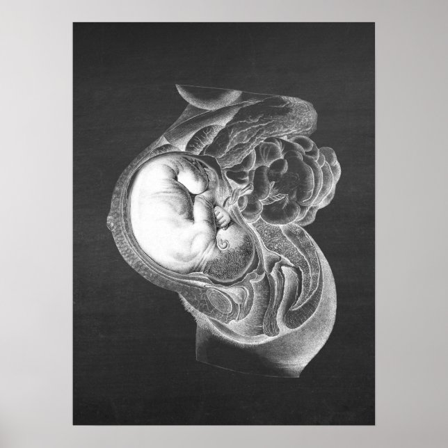 Póster Fetus Womb Anatomy Obstetrics Decor no. 2 (Frente)