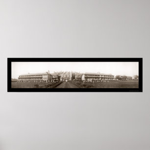 Póster Foto 1912 de Liverpool de la tuberculosis