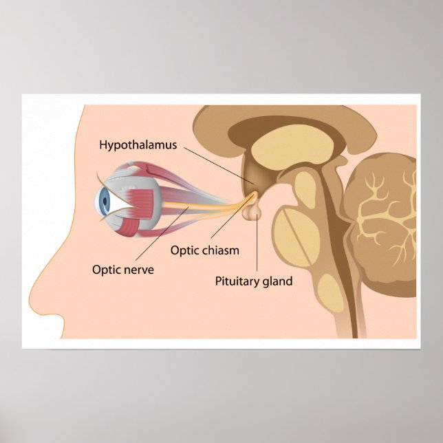 Póster Glándula pituitaria y Poster de quiasas ópticas (Frente)
