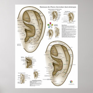Póster Gráfico de Acupuntura de Oreja en Español