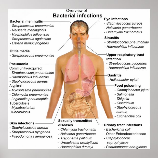Póster Gráfico de las principales infecciones bacterianas (Frente)