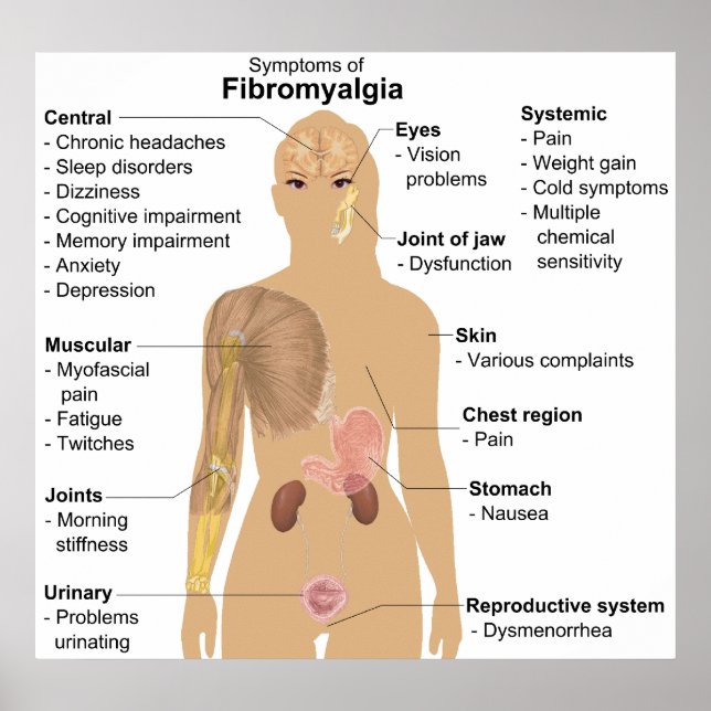 Póster Gráfico de los síntomas de la fibromialgia (Frente)