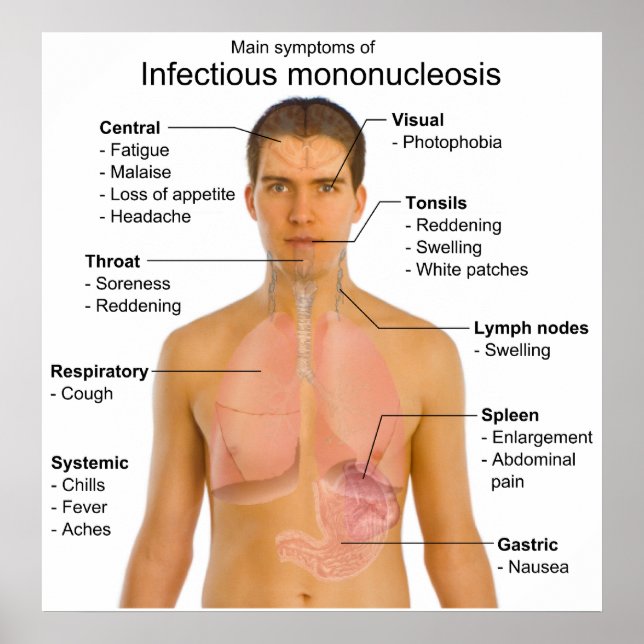 Póster Gráfico de Mononucleosis Infecciosa (Frente)