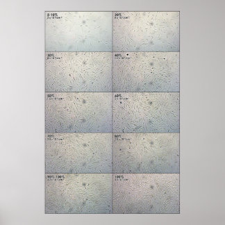 Póster Gráfico de seguimiento de la convergencia