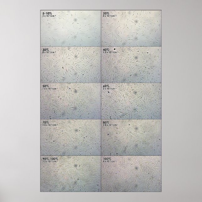 Póster Gráfico de seguimiento de la convergencia (Frente)