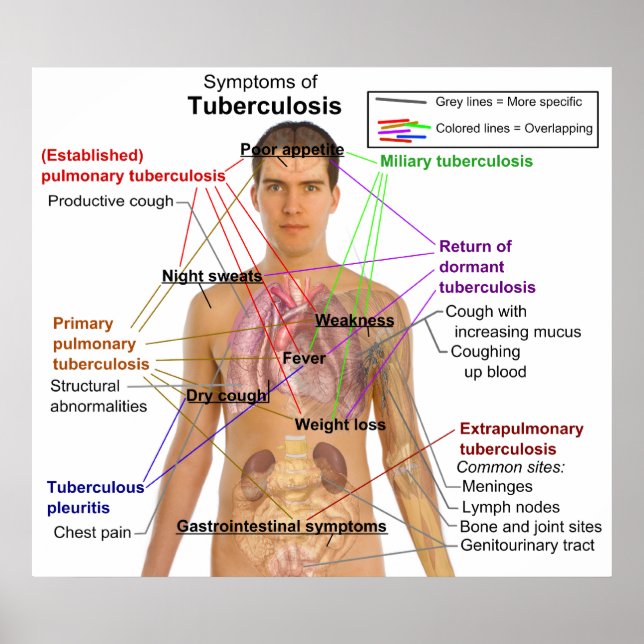 Póster Gráfico de síntomas de la tuberculosis en la human (Frente)