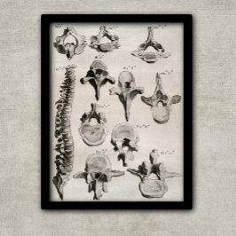 Póster Ilustracion antiguo de columna vertebral, columna