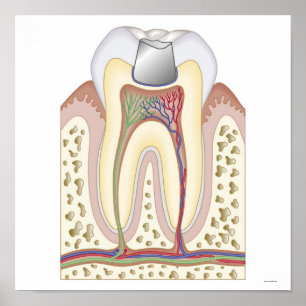 Póster Ilustracion del relleno dental