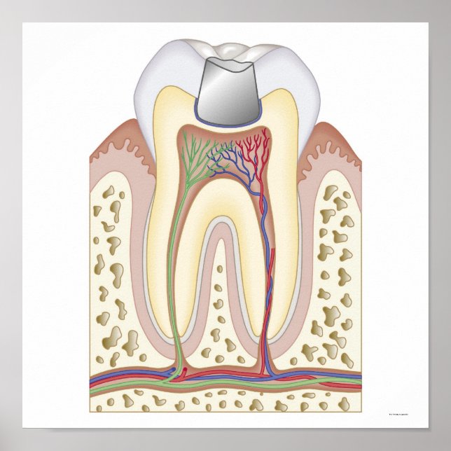 Póster Ilustracion del relleno dental (Frente)