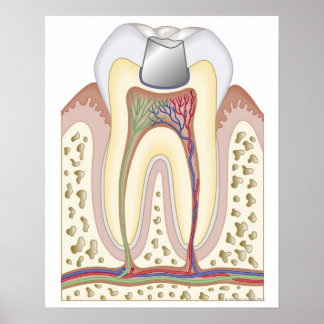 Póster Ilustracion del relleno dental