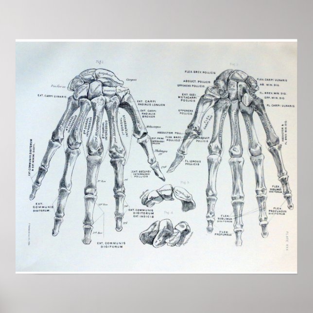 Póster Ilustracion médico de los huesos de la mano