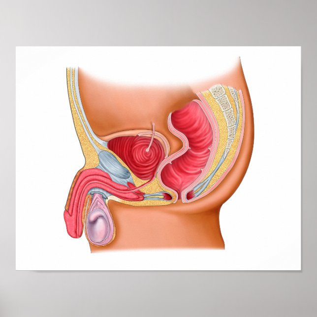 Póster Ilustracion Médico De Una Fistula Rectouretral (Frente)